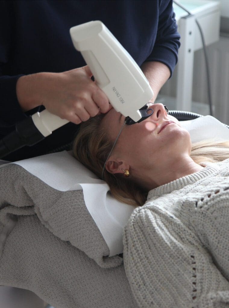 Karsprængninger i ansigtet