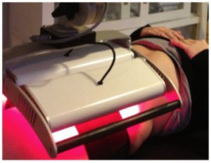 fertilitetsbehandling med laserterapi